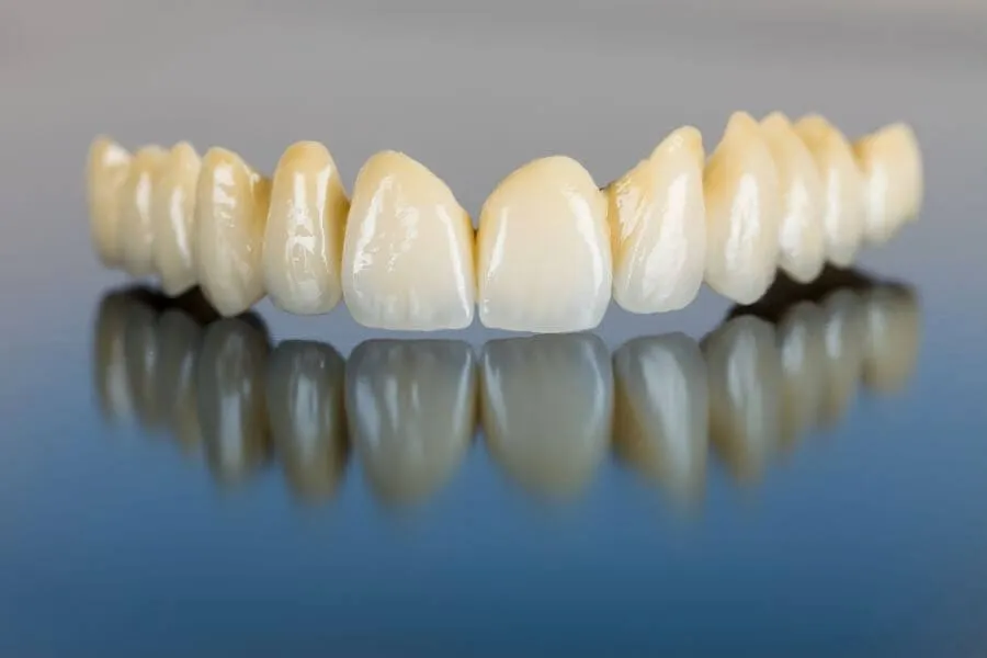 Dentist in Bay Harbor General Dentistry services Artisa Dental (305) 861-9200 Porcelain teeth - dental bridge