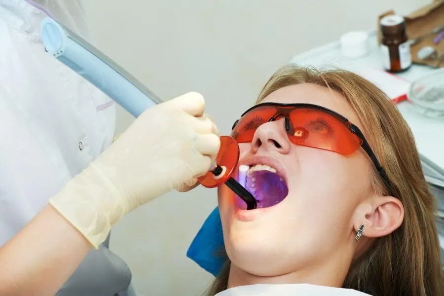 Dentist in Bay Harbor Dental filing of child tooth by ultraviolet light